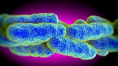 Cleveland hospital: Ohio woman dies of Legionnaires’ disease