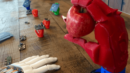 3D printed robotic hand wins UK James Dyson Award