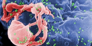 Early antiretroviral therapy prevents non-AIDS outcomes in HIV-infected people