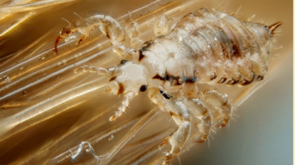 LICE ALERT: Mutant strain of lice becoming resistant to treatment; none