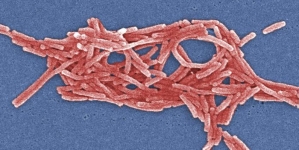 Dead in Bronx Legionnaires’ Outbreak