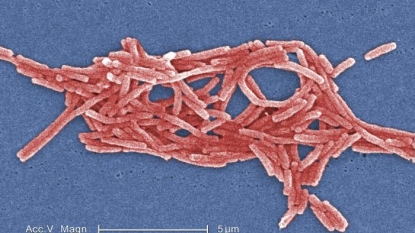 Dead in Bronx Legionnaires’ Outbreak