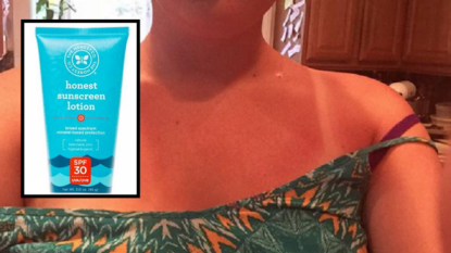 Raging Customers Complain about Serious Sunburns after using Honest Company’s