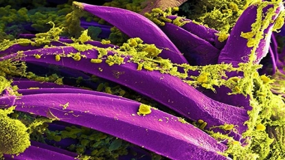 Second Colorado resident dies of plague