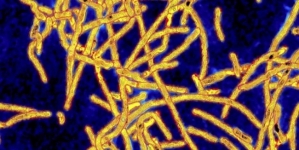 State deploys teams to Bronx to test for Legionella bacteria