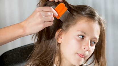 Treatment-Resistant Lice Common Across the US