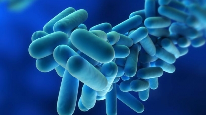 Woman dies of Legionnaires’ disease at Cleveland hospital