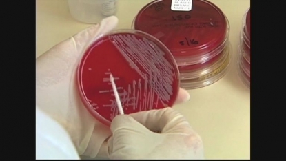 8th person dies in New York Legionnaires’ disease outbreak