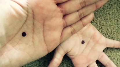 Black Dot campaign could make victims more vulnerable