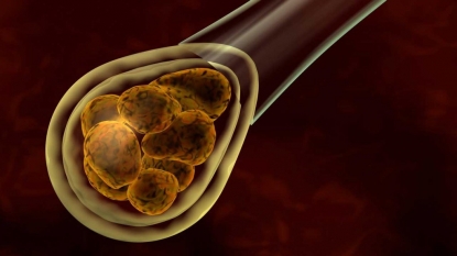 Debate brewing: a group of United Kingdom  scientists want to modify human embryos