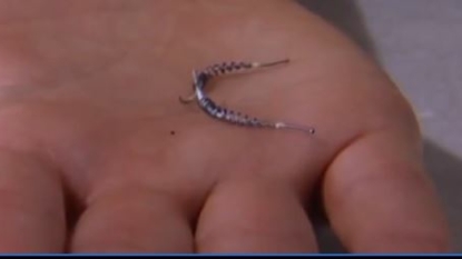 FDA Experts to Review Safety of Essure Birth Control Implant