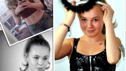 Girl ‘turns yellow’ after drinking three cups of green tea a day