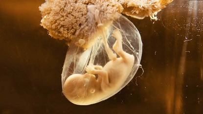 Scientists seek to modify human embryos