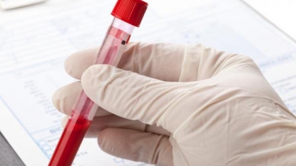 The FDA thinks Pathway Genomics’ cancer blood test could be harmful