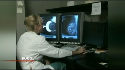 American Cancer Society changes mammogram guidelines