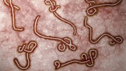 Ebola virus can live up to nine months in semen: CDC