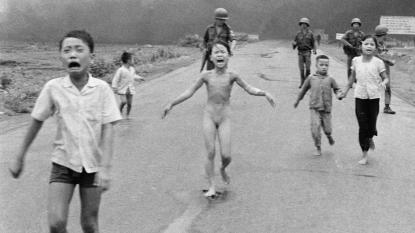 Even after 40 years, napalm girl needs medical help