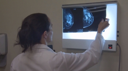 Local woman speaks out about new ACS breast exam guideline