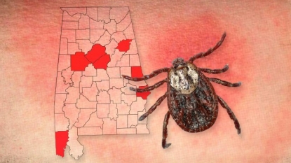 Lyme disease cases spreading from rural areas to suburbs