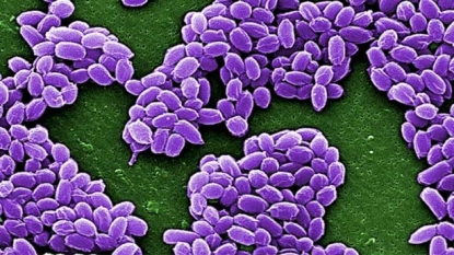 Second anthrax case confirmed in West Country