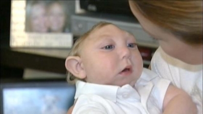 ‘Miracle baby’ Jaxon Buell born with rare disorder defies the odds