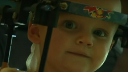 Internally decapitated toddler undergoes ‘miracle’ surgery