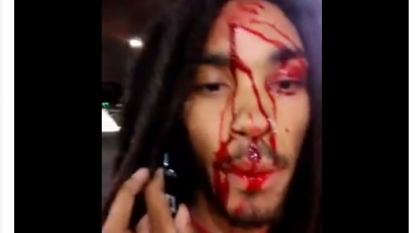 Rapper shot in HEAD manages to film blog in bloody aftermath