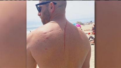 Shark Attacks Man In California And Ends Up Saving His Life