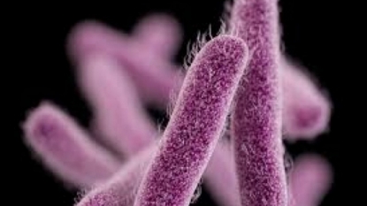 Suspected Shigella cases linked to San Jose restaurant up to 182