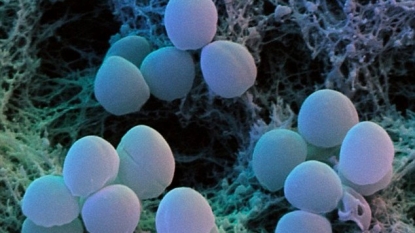 Breast Tumour drug could wipe out SUPERBUG