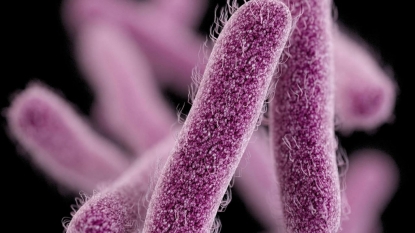 Shigella outbreak: Number of cases continues to increase