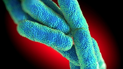 New Cluster of Legionnaires’ Found in New York City