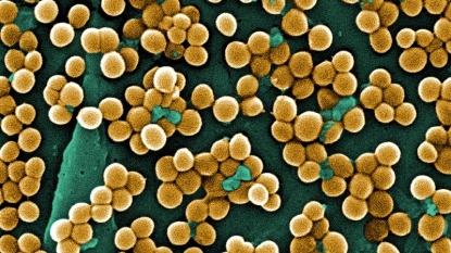 Beta-lactam antibiotics can make MRSA infection worse