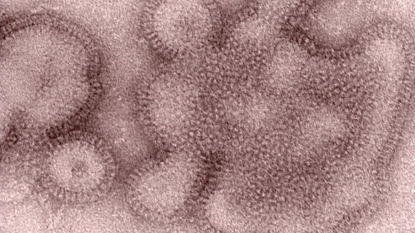 CA: First flu death of season reported