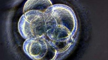 Divorced couple’s frozen embryos must be ‘thawed and discarded,’ judge rules