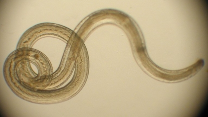 Parasitic Worm Linked To High Fertility Rate In Bolivian Women