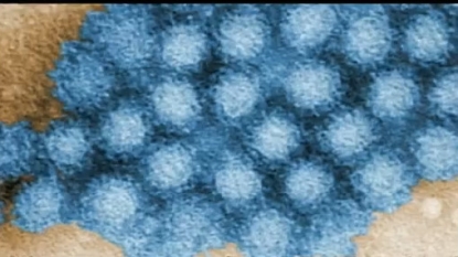 Norovirus (Stomach Flu) is on the Rise in California