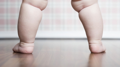 Childhood obesity panel: 40 million kids under 5 overweight