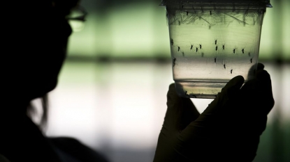 Zika virus link to small-head condition ‘circumstantial’