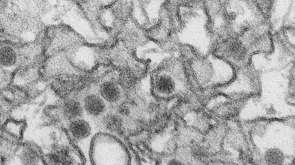 US details cases of 9 pregnant women with Zika virus