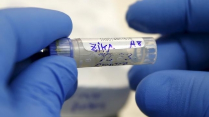 Yolo County resident tests positive for Zika virus