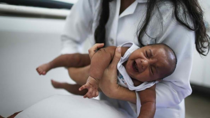 66 people diagnosed with Zika in US