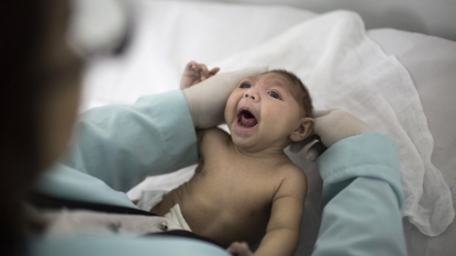 Brazil says confirmed and suspected microcephaly cases rise to 5200