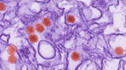 First Case of Zika Virus Confirmed In Nevada