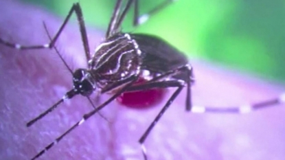 Napa County confirms case of Zika in pregnant woman