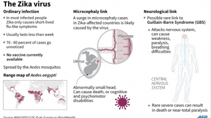 Saskatchewan may have Canada’s first case of Zika transmitted through sex