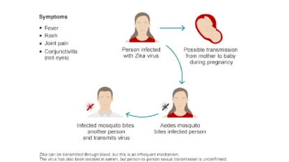 Zika infects lab-grown brain cells, strengthens link to microcephaly