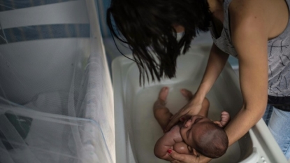 CDC: No doubt now that Zika virus causes rare birth defects