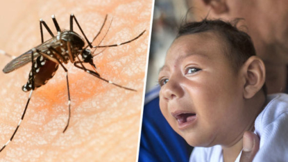 Zika Does Cause Brain Defects, CDC Study Confirms