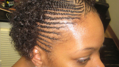 Certain Hairstyles May Increase Risk Of Hair Loss